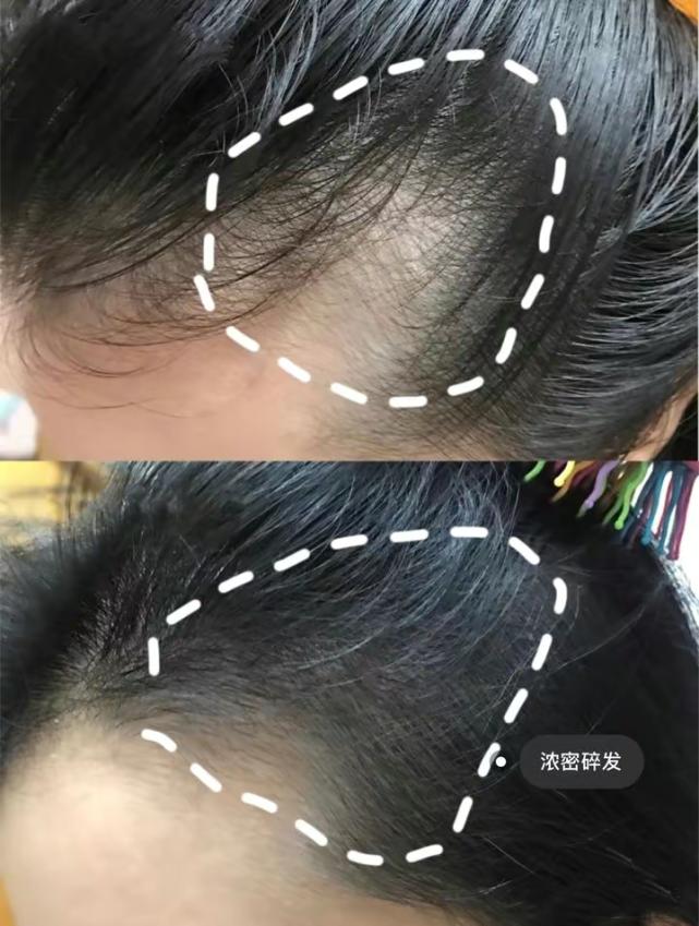 生发洗发水大牌第一名,发根干枯防脱生发洗发水排名第一