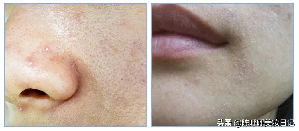 精华水和精华液使用顺序的区别,日常使用精华液护肤步骤