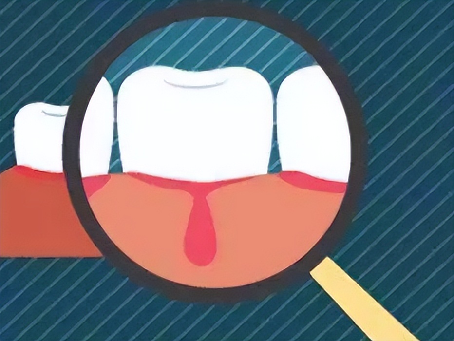 飞利浦牙刷和小米牙刷有什么区别,飞利浦电动牙刷推荐评测2023