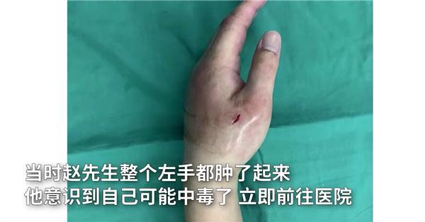 男子被魔鬼鱼毒刺扎,男子被魔鬼鱼蜇伤