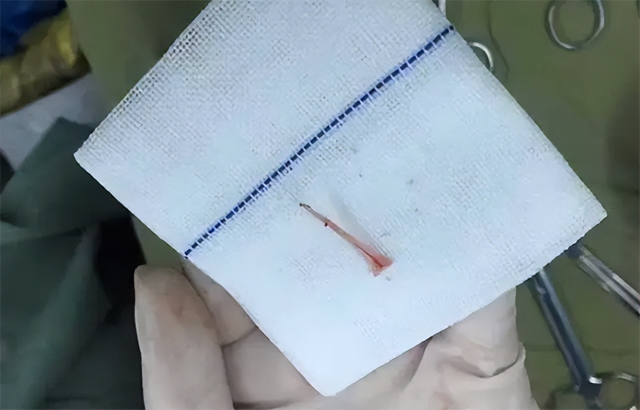 湖南树人刘忠文全部视频,树人刘忠文后续