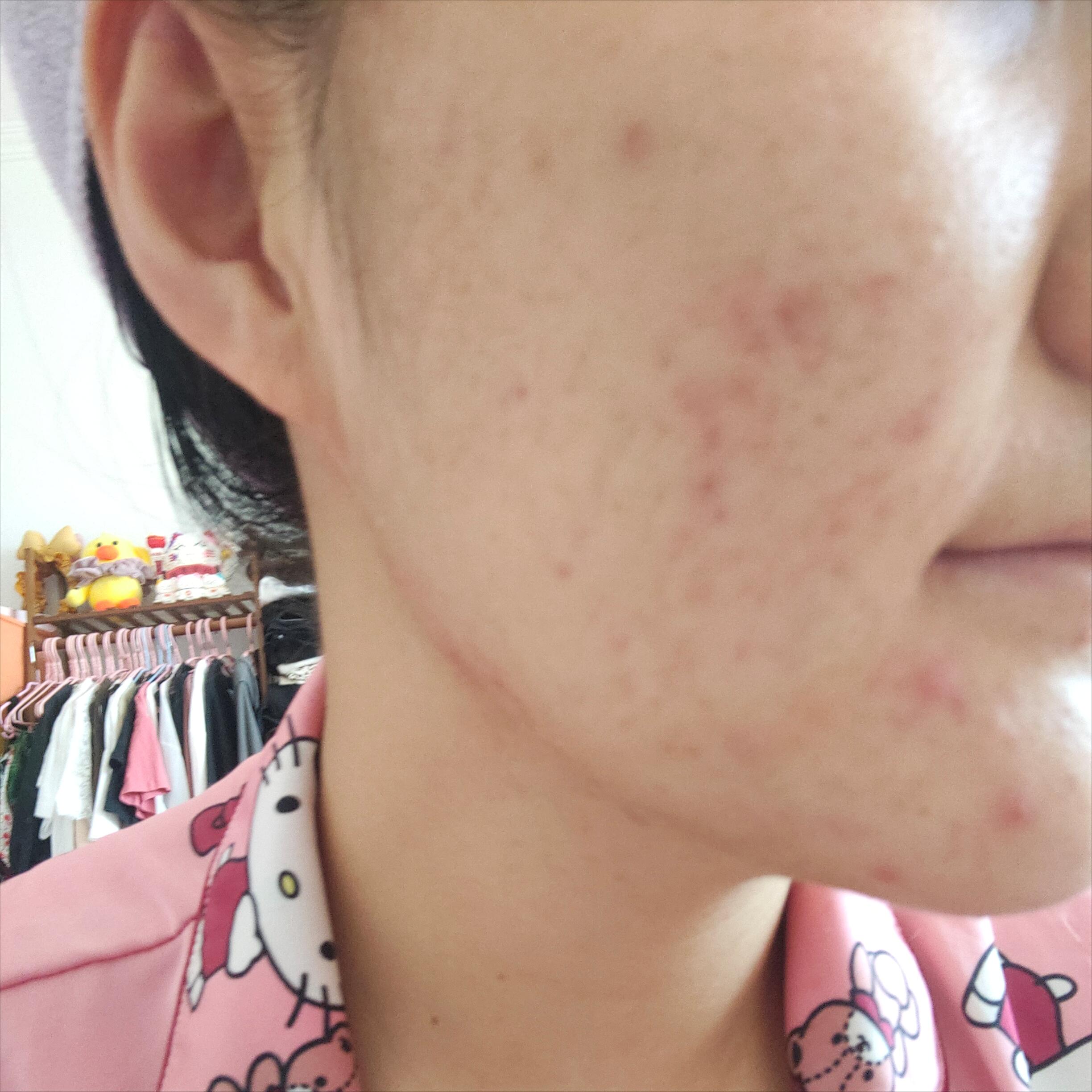 雅诗兰黛dw粉底液适合什么皮肤,粉底液夏天推荐兰蔻