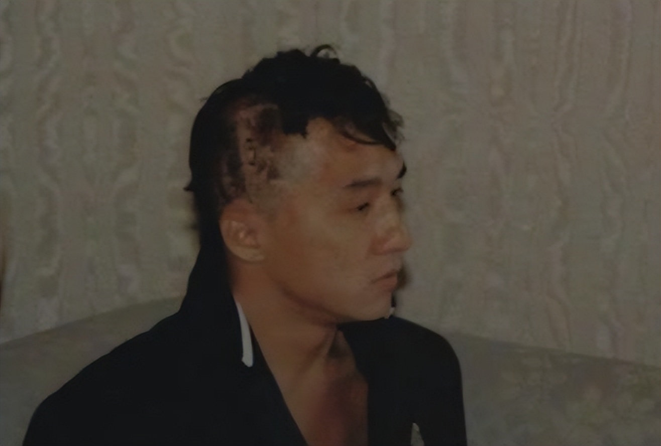 7次断手、全身100多针、大小便*禁失**，这些武打明星让人动容