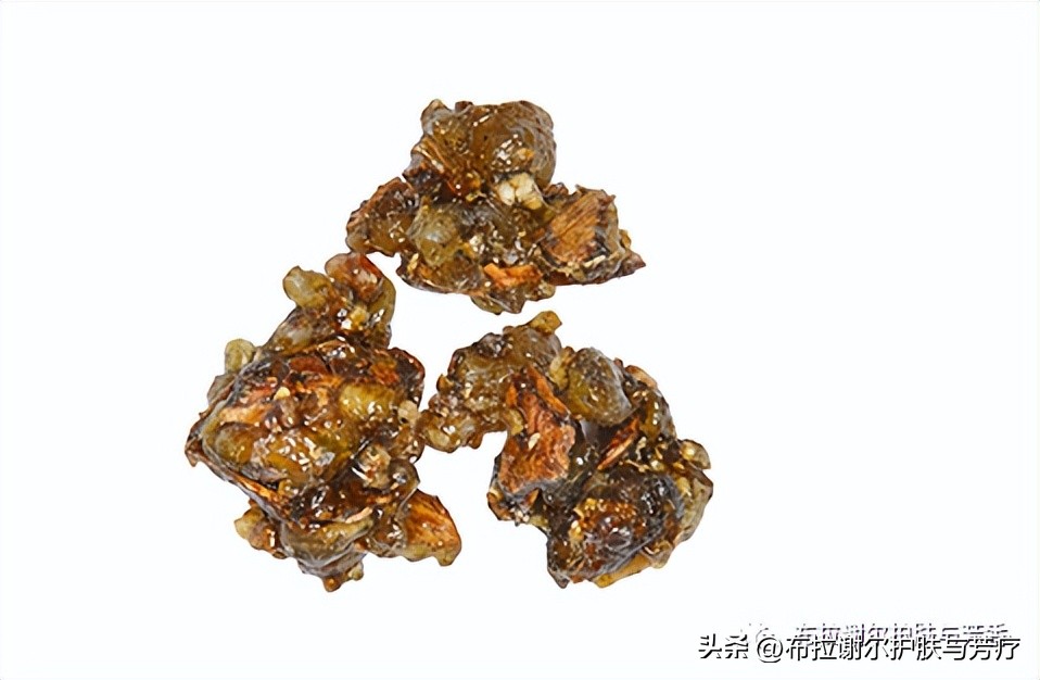 乳香精油紧致皮肤,乳香精油扩张血管