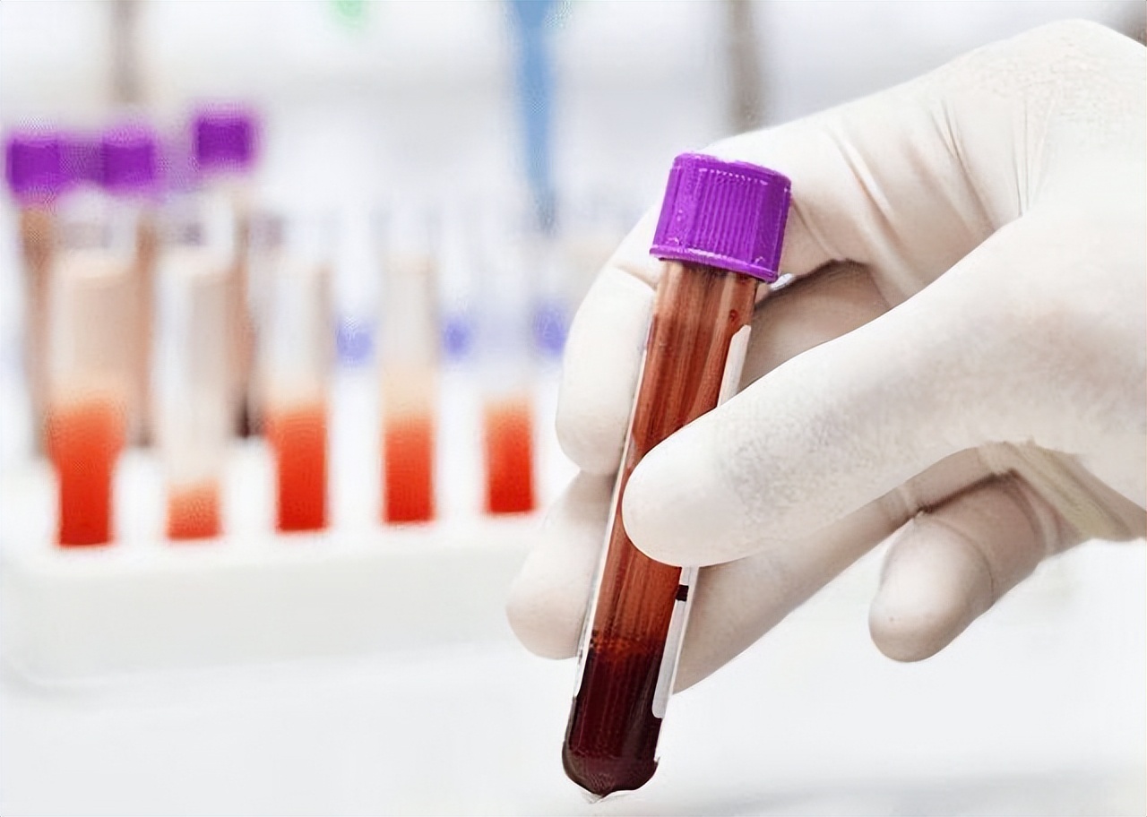 血常规哪些项目异常要警惕,血常规这几项异常一定要引起重视