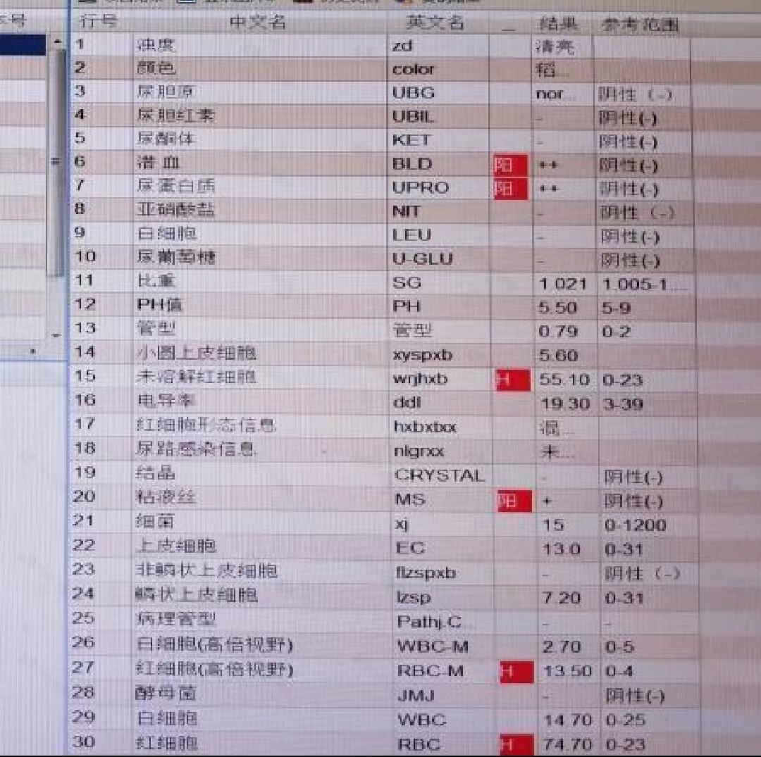肾病综合征膜性肾病能吃茄子吗,肾病综合征膜性肾病二期治疗周期