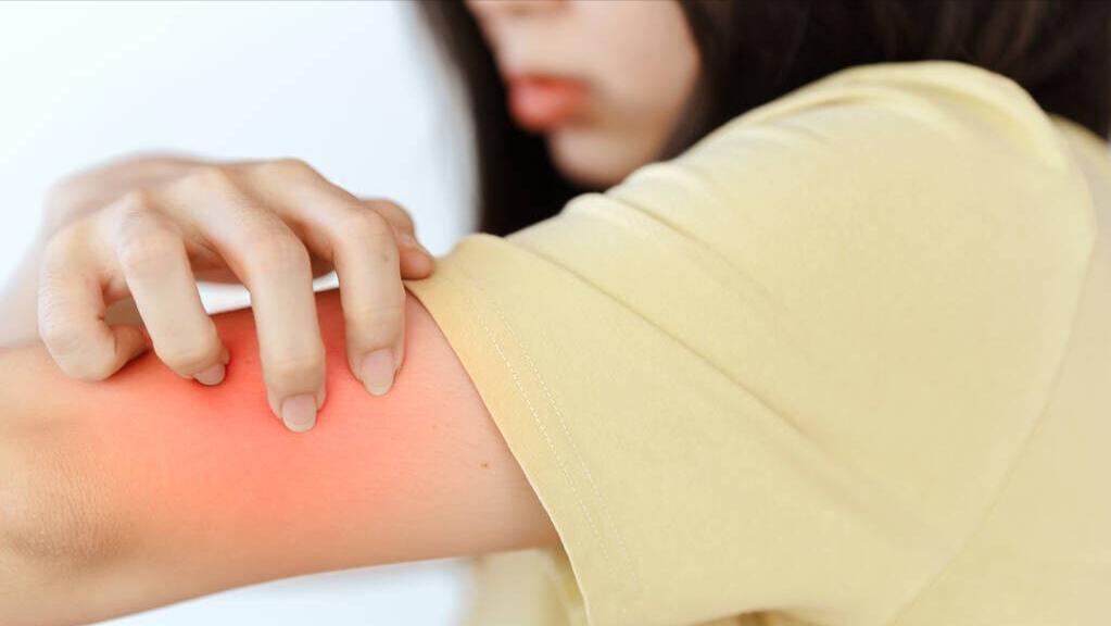 过敏原是怎么引起过敏的,过敏危害的分析