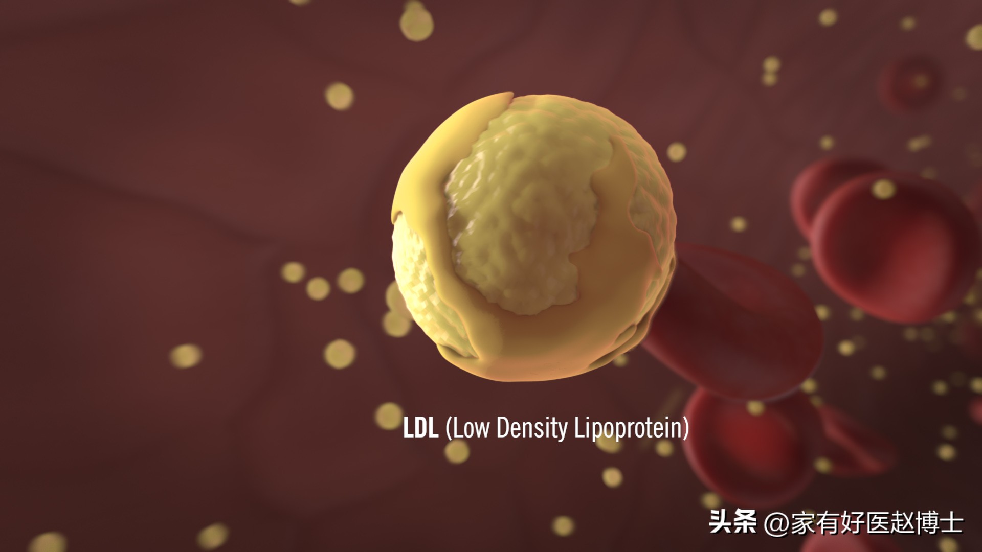 吃他汀引起高密度脂蛋白降低,为什么吃他汀低密度胆固醇还升高