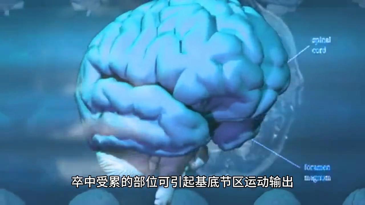 帕金森叠加综合征能手术治疗吗,帕金森综合症最好的治疗方法