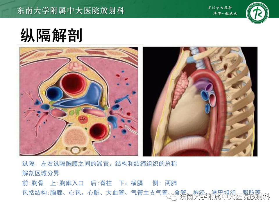 好文分享值得深思,纵隔精原细胞瘤