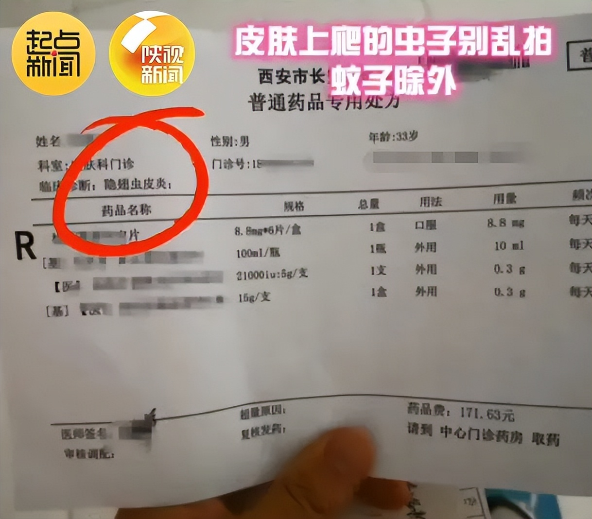 “我的脸被它毁容了…”毒液堪比硫酸！西安也有！