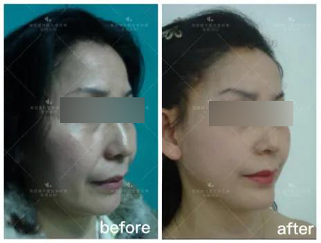 为什么随着年龄脸越来越大,为什么随着年龄的增长脸越来越宽