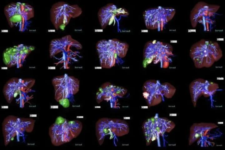 医学影像目标检测框架,开源数据集目标检测