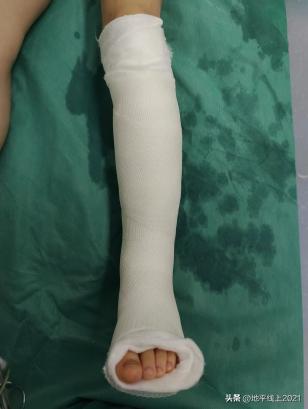 小孩被自行车撞康复要赔偿,孩子不小心被自行车撞了一下