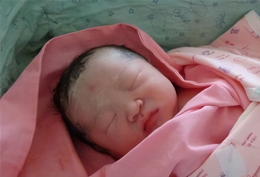 怎么可以让出生的宝宝皮肤白白的,刚出生的宝宝皮肤有哪些情况