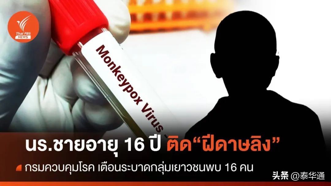 泰国15岁男子感染艾滋病,泰国爆发猴痘