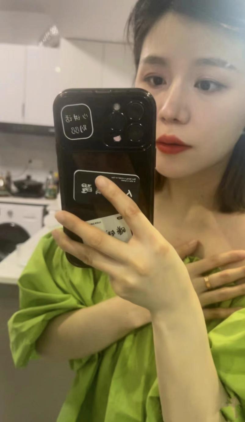 猪鼻整形手术,鼻头肥大鼻子整形成功案例