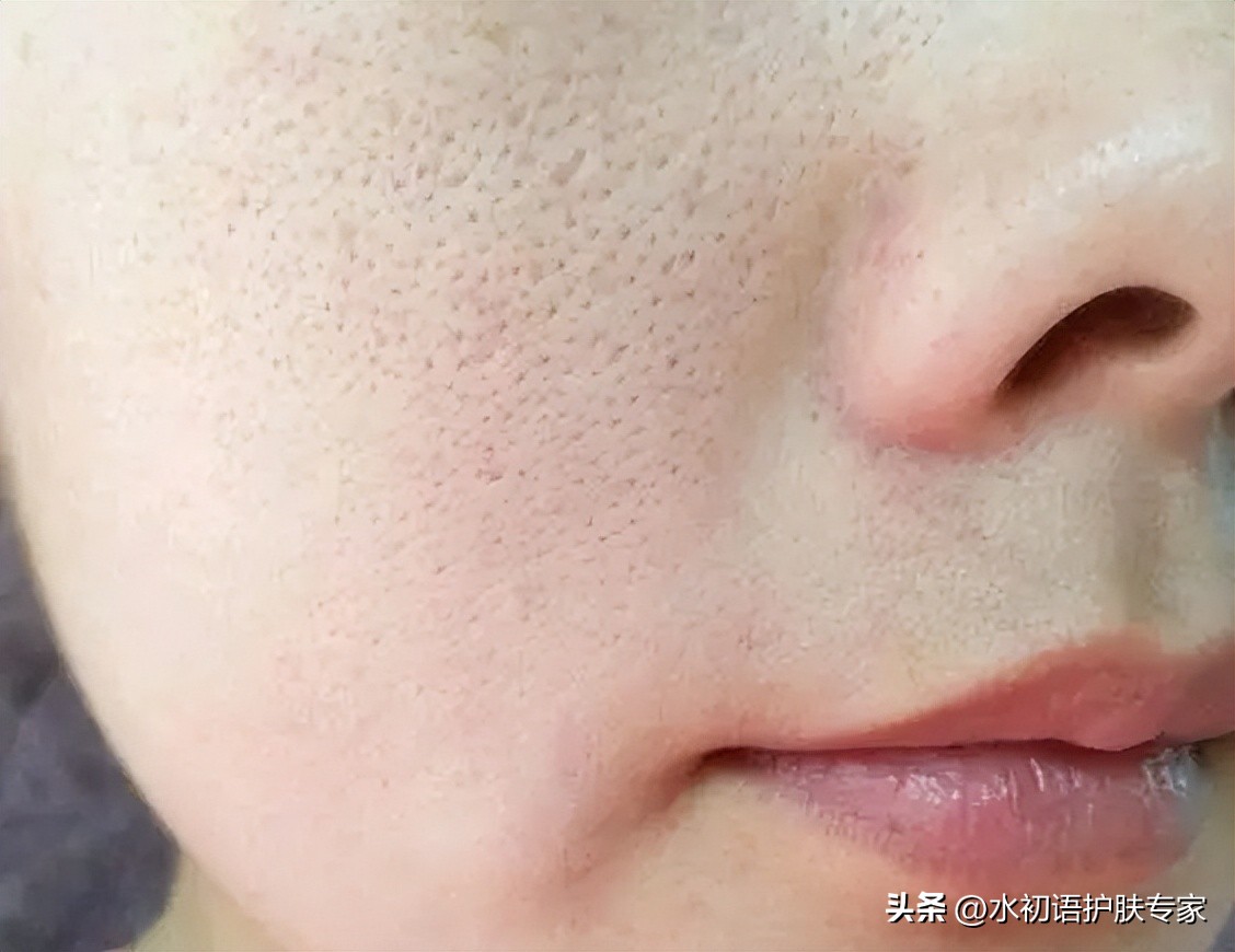 皮肤油毛孔粗大暗黄用什么护肤品,油皮毛孔粗大公认最好用的护肤水