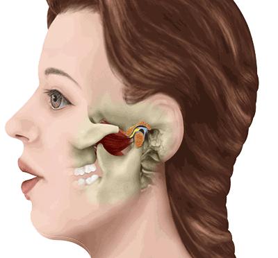 15岁女孩的嘴巴张不开怎么办,女孩患病张不开嘴