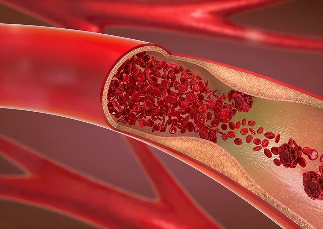一到冬天皮肤干燥掉皮屑像下雪,一到冬天皮肤干燥皮屑满天飞