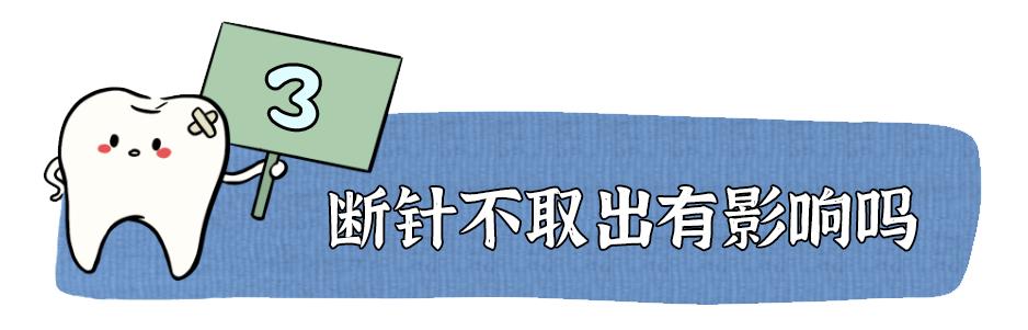 做根管治疗期间牙齿劈了,做根管治疗的牙断了一部分