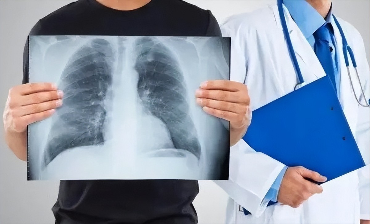 从呼吸困难到咳出肿瘤组织，一个肺癌患者亲述在美国治疗历程