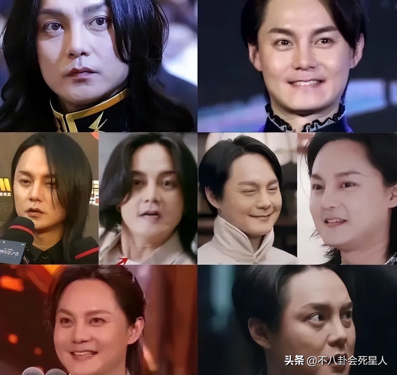 脸部垮掉的男人,脸部塌陷的男生