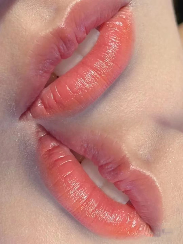 纹唇后不想要了纹唇失败怎么办,纹唇的注意事项具体有什么