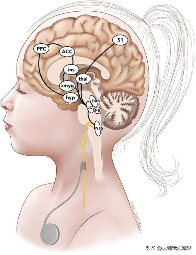 什么类型的癫痫比较好治疗,癫痫的手术治疗方法有什么