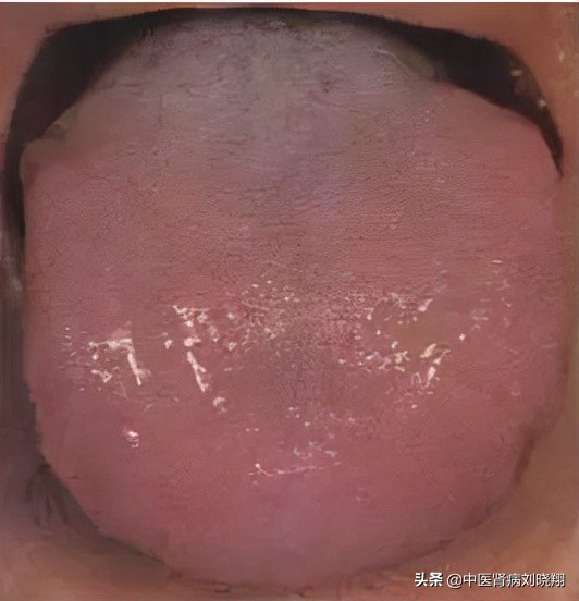 刘主任让病人伸舌头，看的是什么？