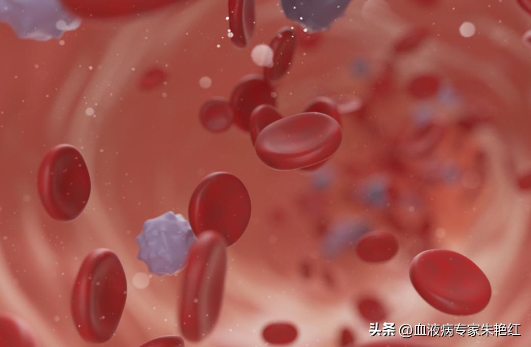 高危mds引起的贫血有什么好药吃,高危mds化疗期间的死亡率