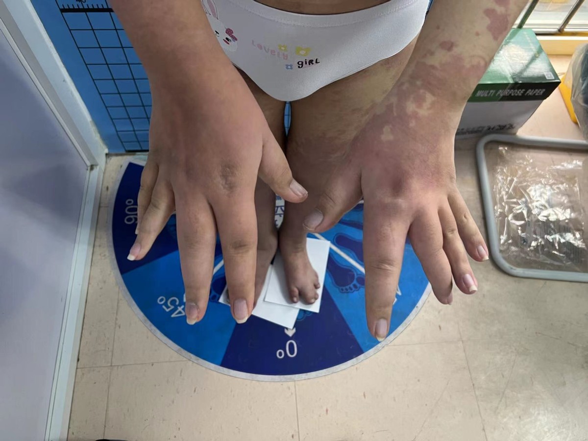 14岁女孩非经期出血,14岁女孩非月经期出血是怎么回事