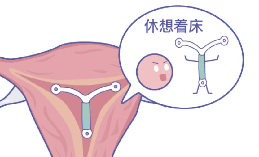 老年女性体内的节育环还用取掉吗,体内节育环几年要取掉