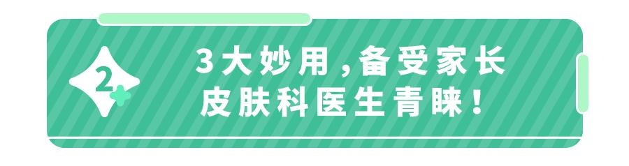 儿童蚊虫叮咬止痒用青草膏好吗,红屁屁过敏用什么药膏