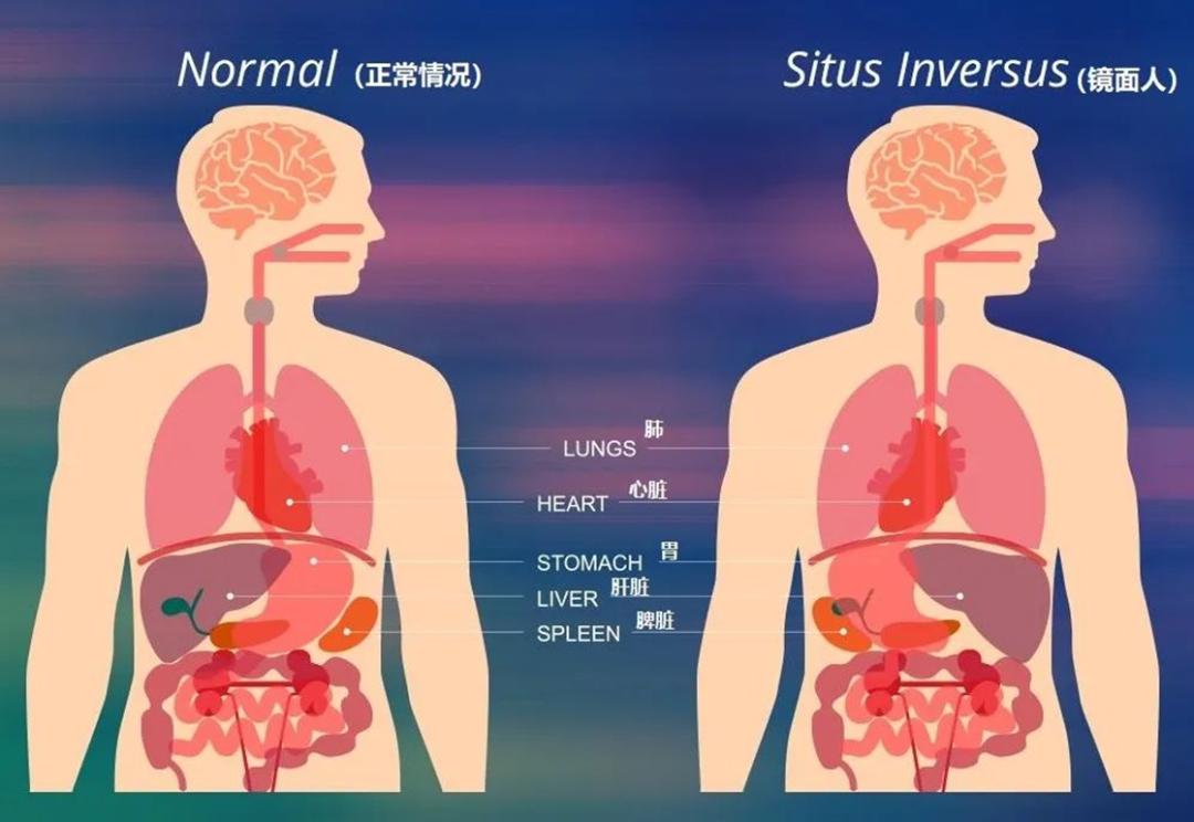 胸椎稍向右侧侧凸怎么矫正,儿童胸椎向右侧凸是什么意思