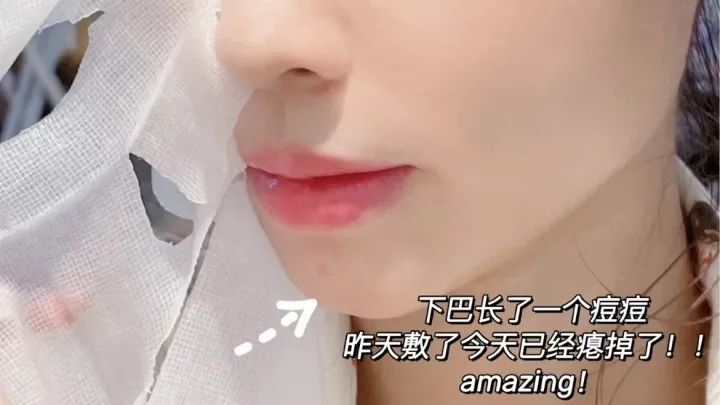 祛痘面膜淡化痘印测评,祛痘淡斑面膜测评