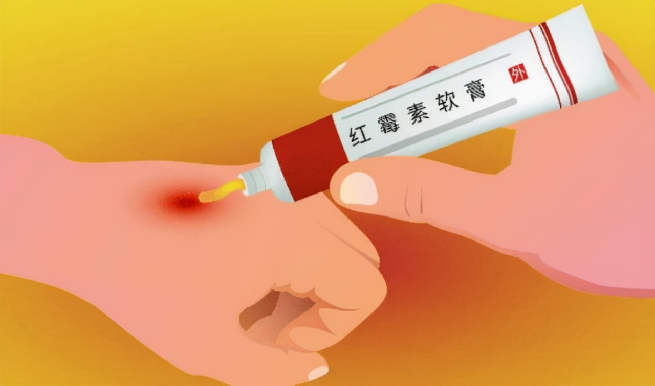 2块钱红霉素软膏成了祛斑专家,2块钱一支的红霉素软膏3个功效