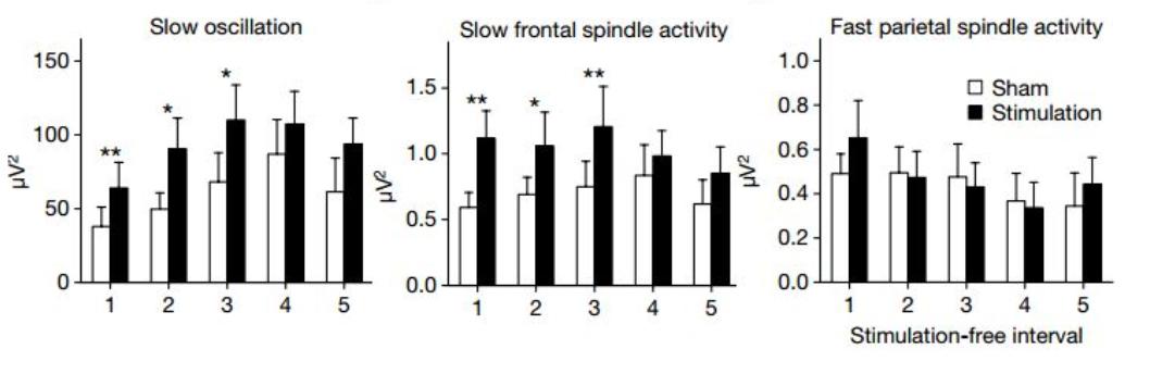 tdcs训练仪真的管用吗,市面上使用tdcs技术的仪器有哪些