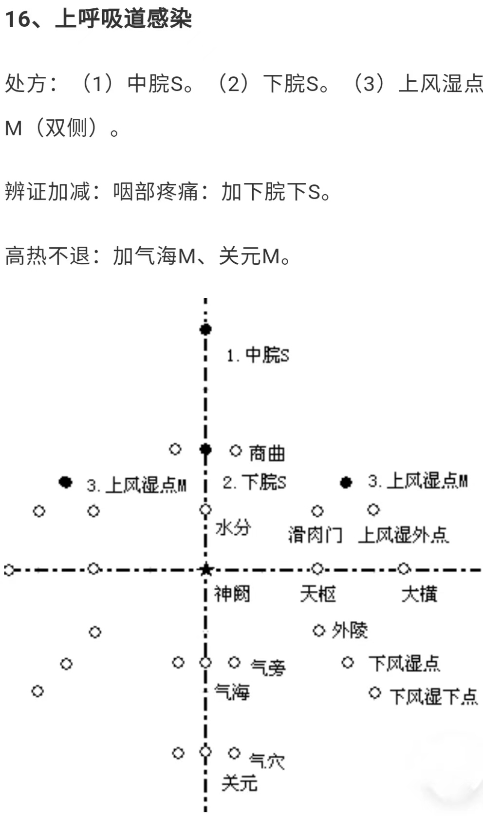 腹针疗法,腹针疗法最新处方大全