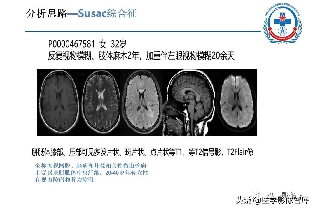 胼胝体变性治疗方法,原发性胼胝体病变治疗