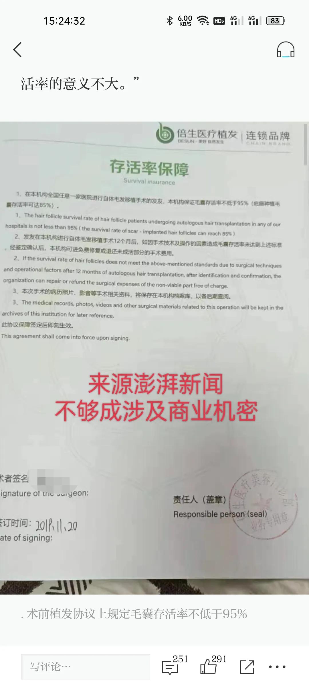 天生发际线高植发长久靠谱吗,发际线高植发一年的效果