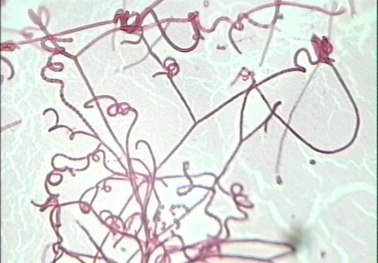 牛老是起舌钉是什么原因,牛一直翘舌头怎么回事