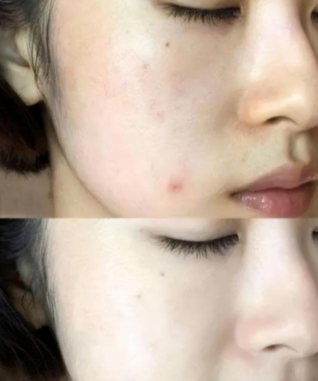 坚持用精华液和不用精华液的区别,精华跟平时用的精华液有什么不同