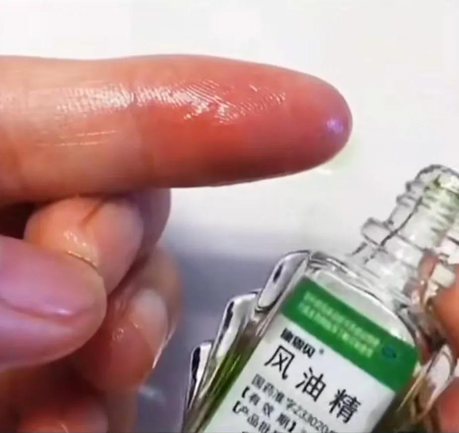 胶水弄到手上了该怎样去除胶水,手上粘了强力胶水怎么处理