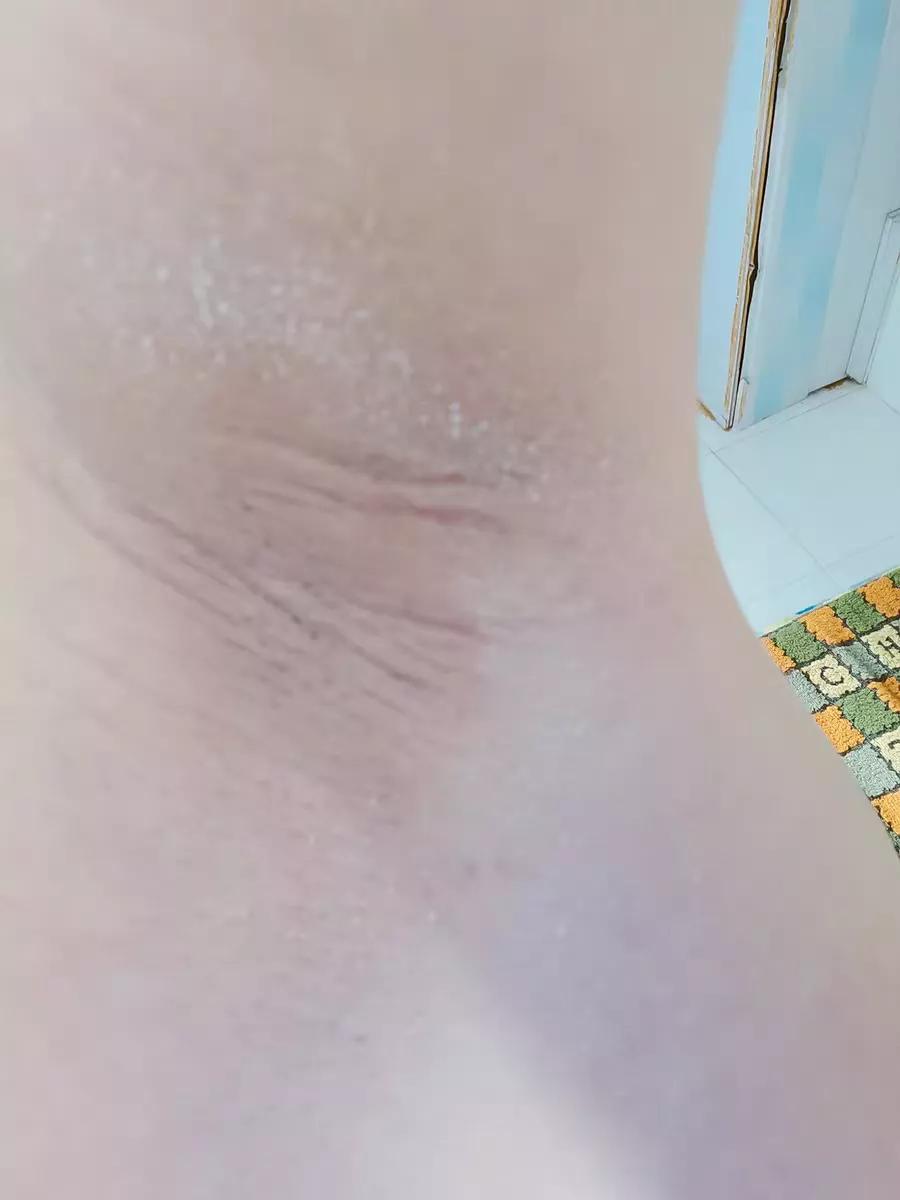 狐臭止汗露推荐测评第一名,狐臭止汗露推荐不显黑