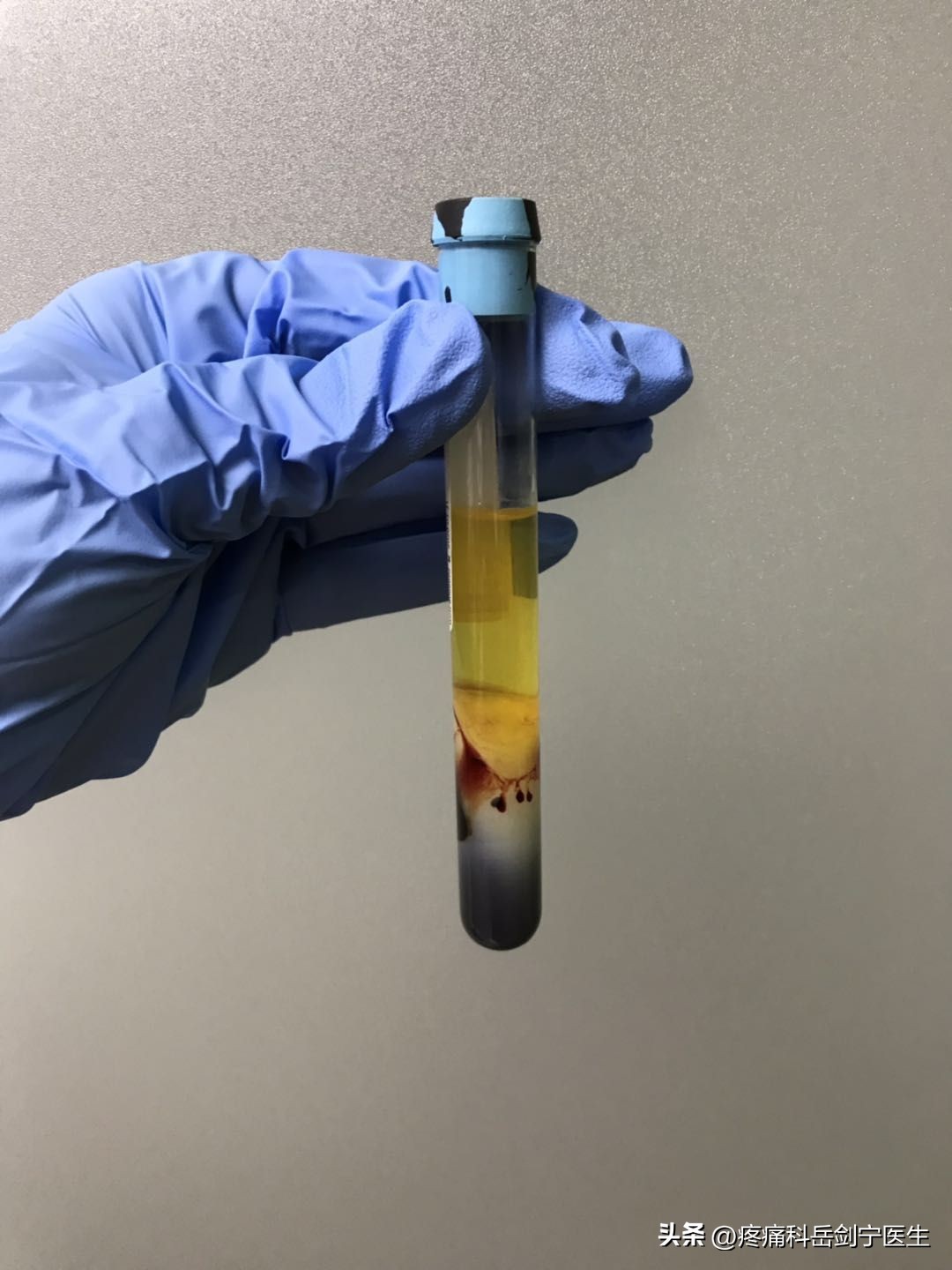 脚踝长期疼痛用什么膏药,脚踝按压痛是什么原因