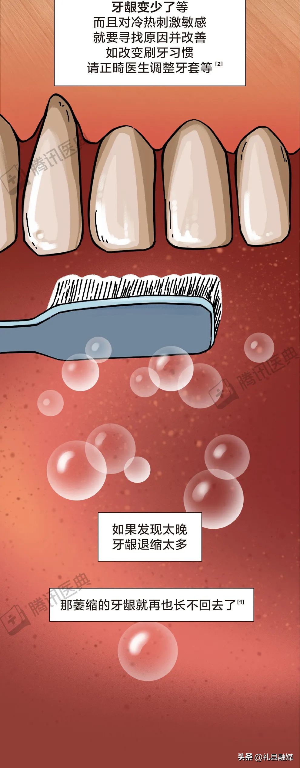 牙缝隙大吃菜就塞牙怎么修复,牙齿吃菜老塞牙怎么办