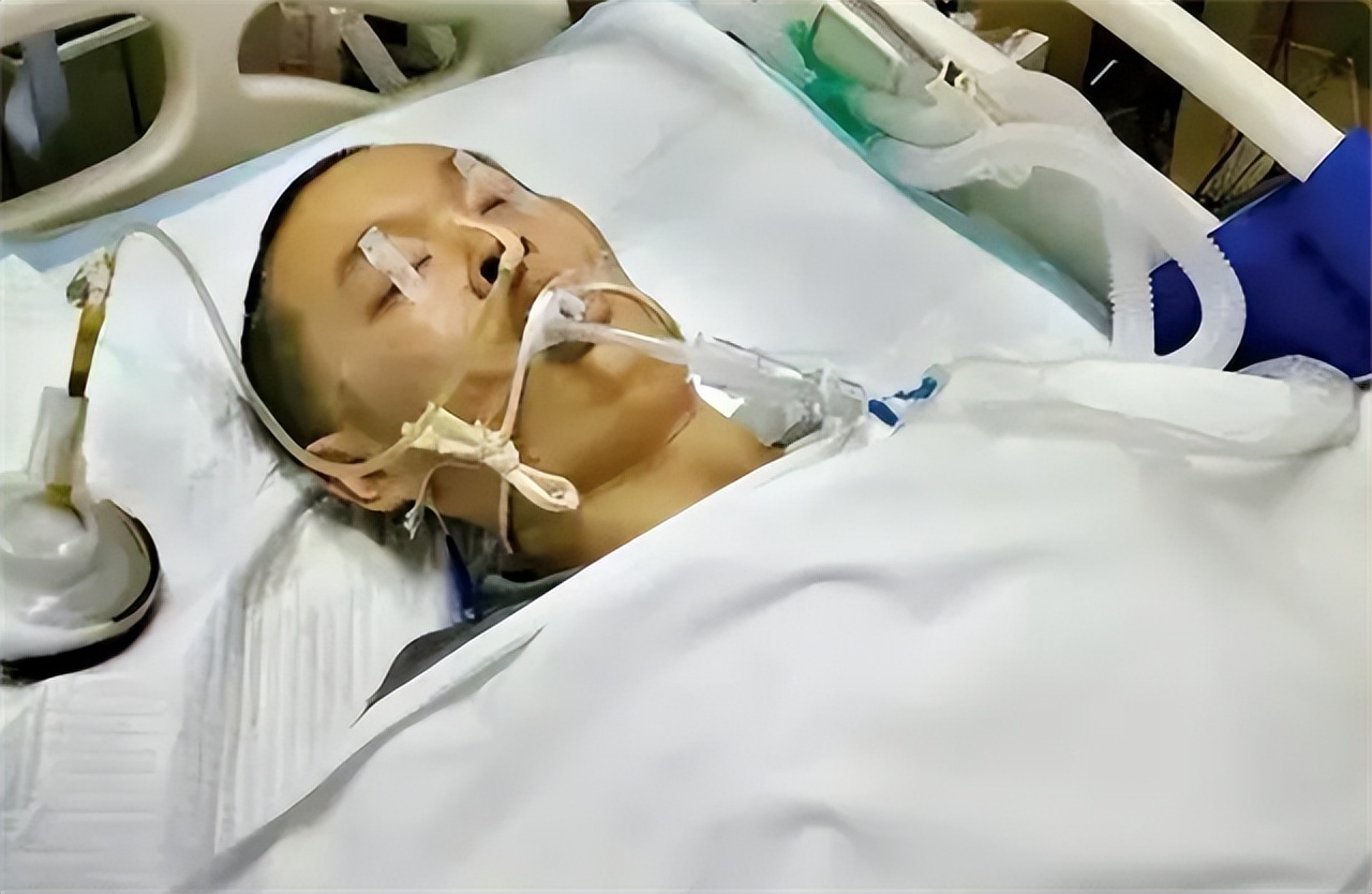 男子意外烧伤用蛆来治疗后续,小伙双腿被烧伤医生用蛆治疗