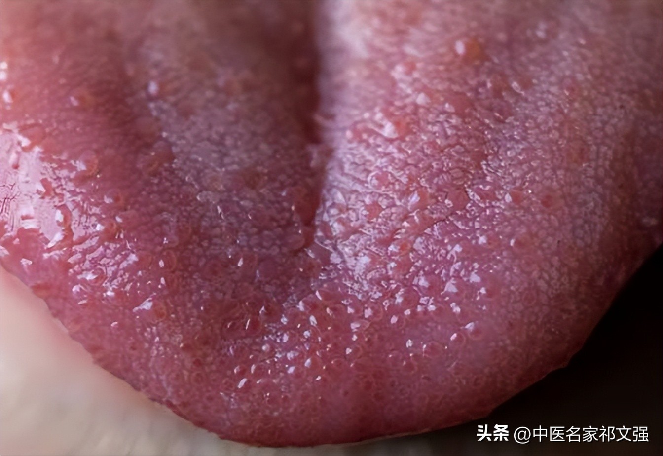 治胃病的医生有高明的望诊方法吗,看胃病的求医之路