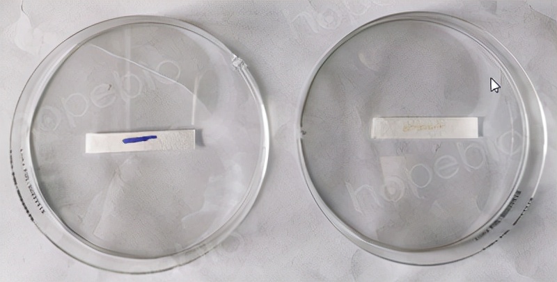 氧化酶试验的原理及意义,氧化酶试验的操作方法